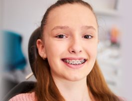 What Can One Eat in the First Week of Braces?